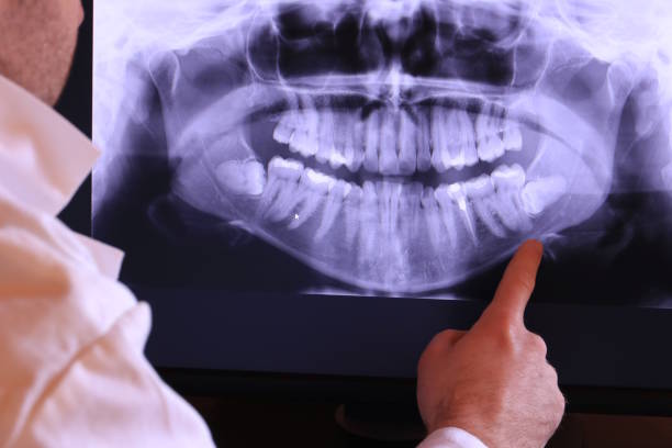 Best Mobile Emergency Dentist in Blue Island, IL