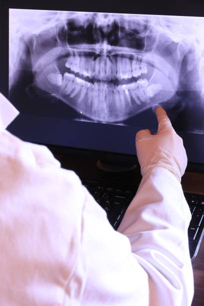 Best Emergency Dentist for Knocked-Out Tooth in Blue Island, IL